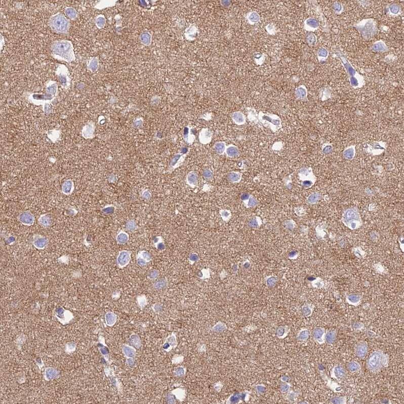 TMEM161B Antibody - BSA Free Immunohistochemistry: TMEM161B Antibody - BSA Free [NBP1-93488]