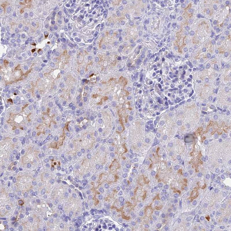 TMEM161B Antibody - BSA Free Immunohistochemistry: TMEM161B Antibody - BSA Free [NBP1-93488]