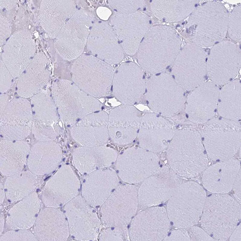 TMEM161B Antibody - BSA Free Immunohistochemistry: TMEM161B Antibody - BSA Free [NBP1-93488]