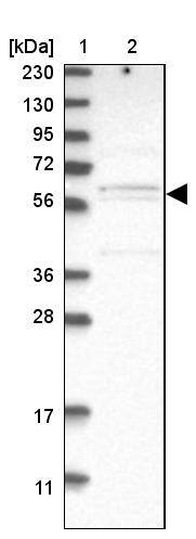 HROB Antibody - BSA Free Western Blot: HROB Antibody - BSA Free [NBP1-93494]