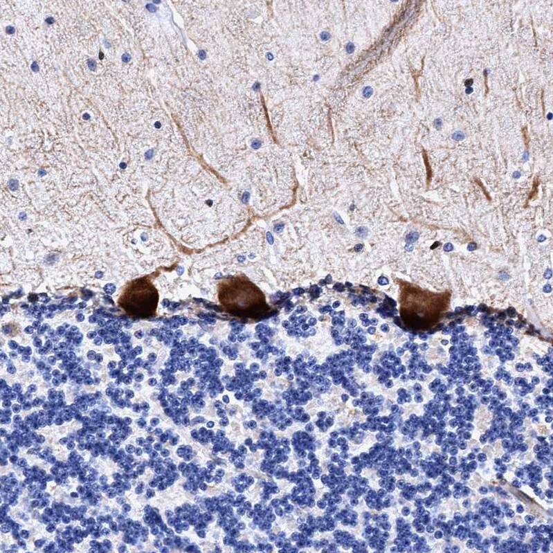 FAM100B Antibody - BSA Free Immunohistochemistry: FAM100B Antibody - BSA Free [NBP1-93496]