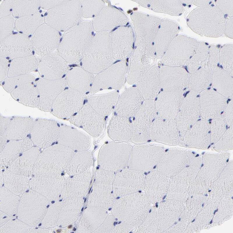 MOSPD2 Antibody - BSA Free Immunohistochemistry: MOSPD2 Antibody - BSA Free [NBP1-93499]