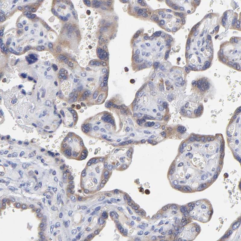 MOSPD2 Antibody - BSA Free Immunohistochemistry: MOSPD2 Antibody - BSA Free [NBP1-93499]
