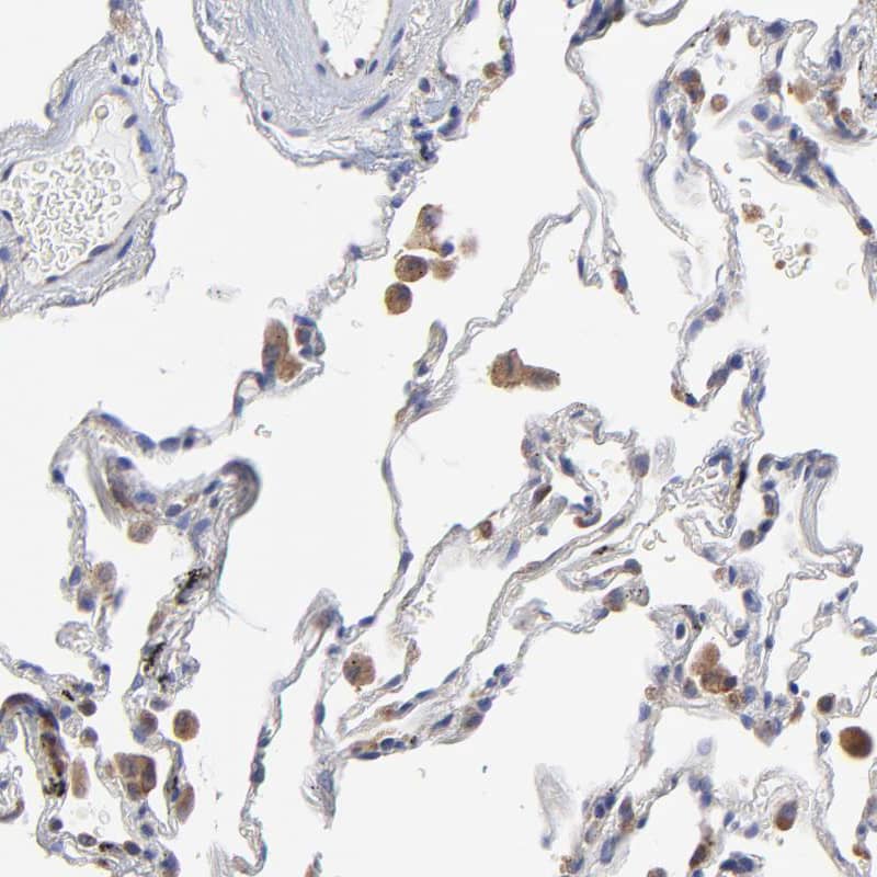 MOSPD2 Antibody - BSA Free Immunohistochemistry: MOSPD2 Antibody - BSA Free [NBP1-93499]