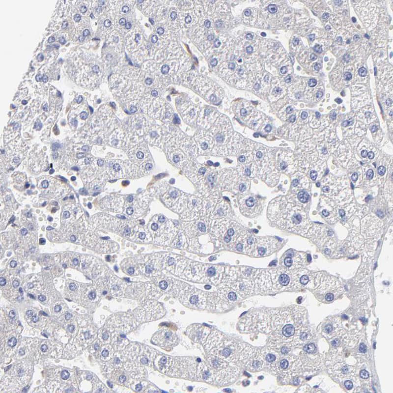 MOSPD2 Antibody - BSA Free Immunohistochemistry: MOSPD2 Antibody - BSA Free [NBP1-93499]