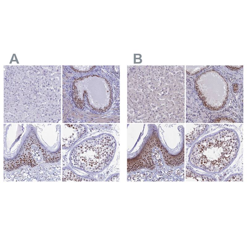 CCDC86 Antibody - BSA Free Immunohistochemistry: CCDC86 Antibody - BSA Free [NBP1-93500]