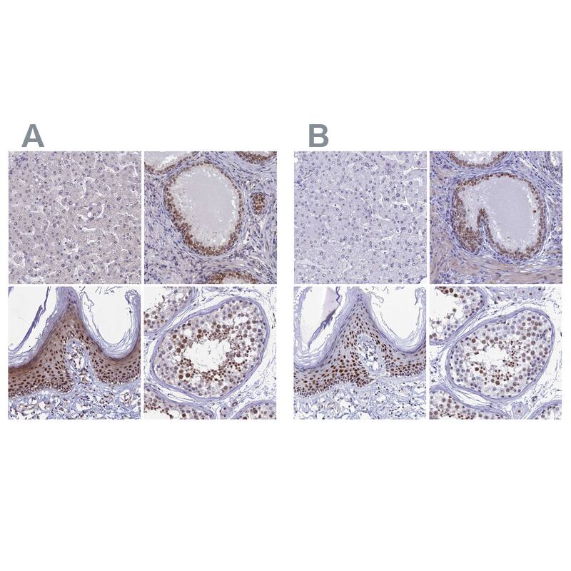 CCDC86 Antibody - BSA Free Immunohistochemistry: CCDC86 Antibody - BSA Free [NBP1-93501]