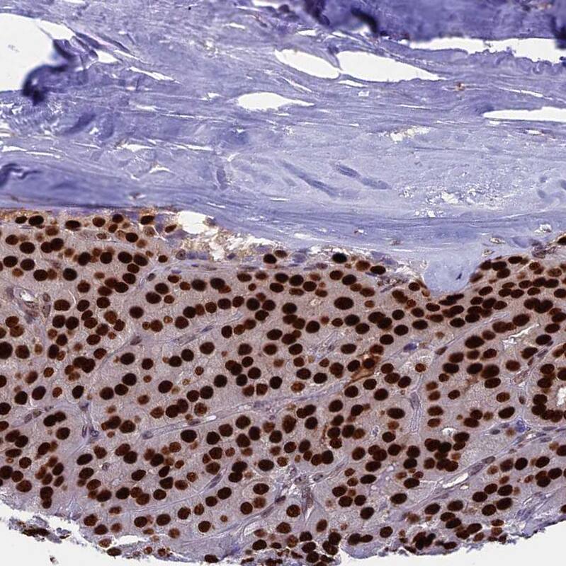 CCDC86 Antibody - BSA Free Immunohistochemistry: CCDC86 Antibody - BSA Free [NBP1-93501]