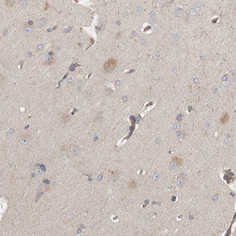 C9orf72 Antibody - BSA Free Immunohistochemistry: C9orf72 Antibody - BSA Free [NBP1-93504]