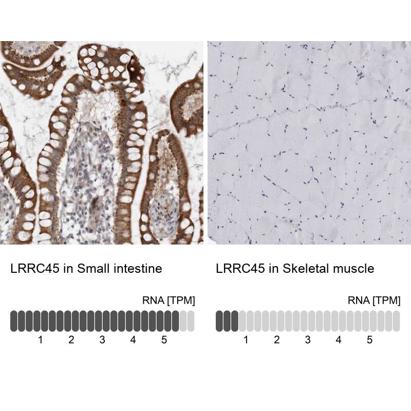 LRRC45 Antibody - BSA Free Immunohistochemistry: LRRC45 Antibody - BSA Free [NBP1-93510]