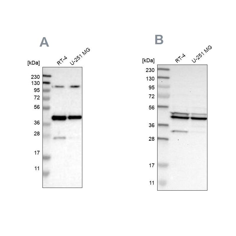 CCDC104 Antibody - BSA Free Western Blot: CCDC104 Antibody - BSA Free [NBP1-93514]