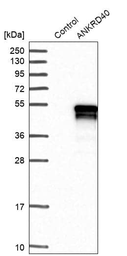 ANKRD40 Antibody - BSA Free Western Blot: ANKRD40 Antibody - BSA Free [NBP1-93515]