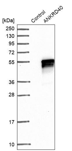 ANKRD40 Antibody - BSA Free Western Blot: ANKRD40 Antibody - BSA Free [NBP1-93516]
