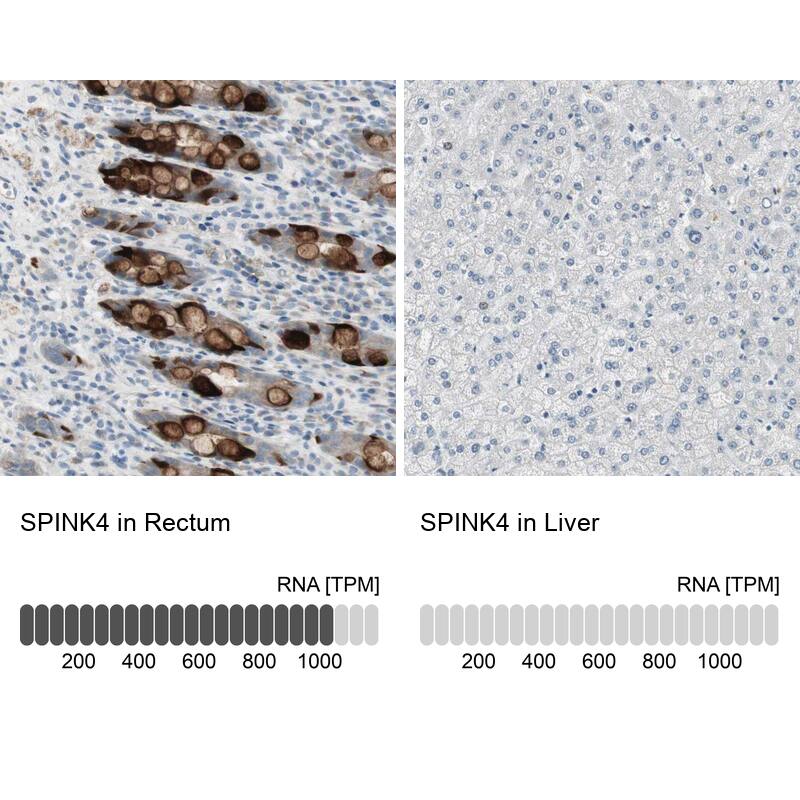 SPINK4 Antibody - BSA Free Immunohistochemistry: SPINK4 Antibody - BSA Free [NBP1-93519]