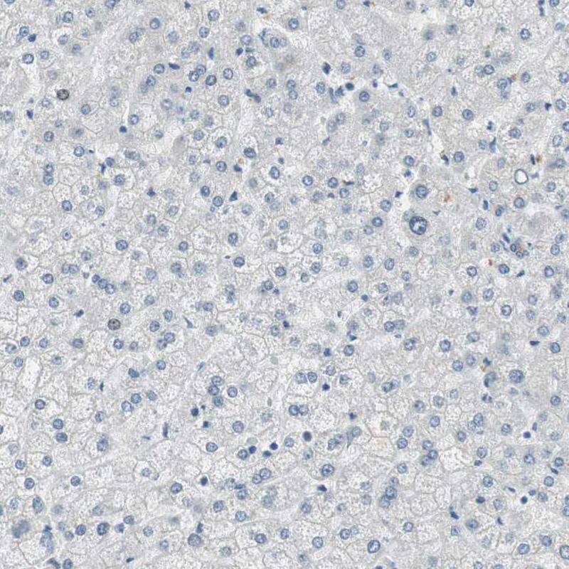 SPINK4 Antibody - BSA Free Immunohistochemistry: SPINK4 Antibody - BSA Free [NBP1-93519]