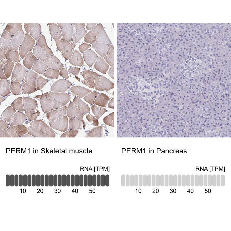 PERM1 Antibody - BSA Free Immunohistochemistry: PERM1 Antibody - BSA Free [NBP1-93520]
