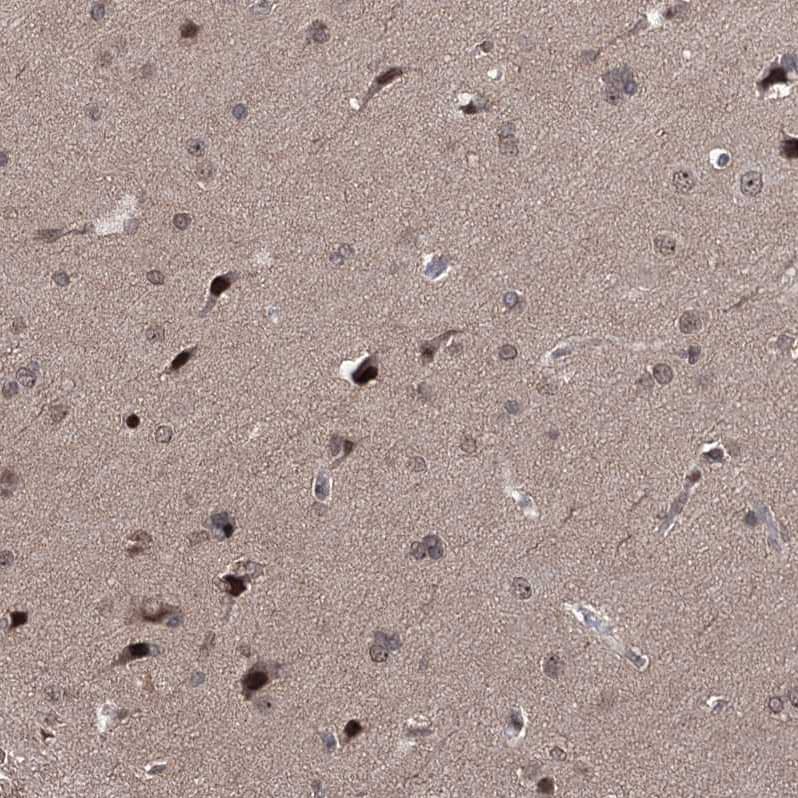 CCDC77 Antibody - BSA Free Immunohistochemistry: CCDC77 Antibody - BSA Free [NBP1-93521]