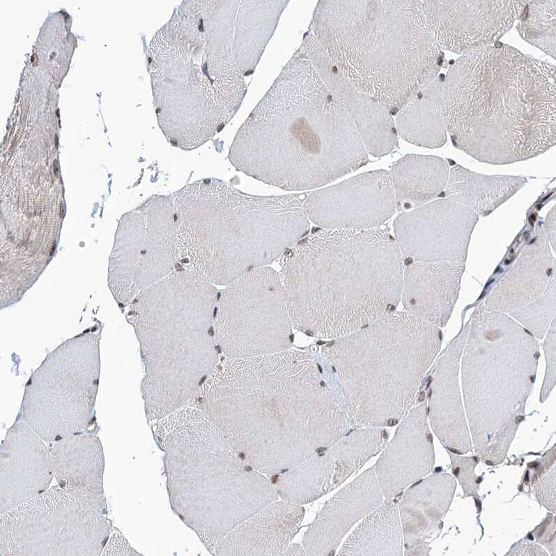 CCDC77 Antibody - BSA Free Immunohistochemistry: CCDC77 Antibody - BSA Free [NBP1-93521]