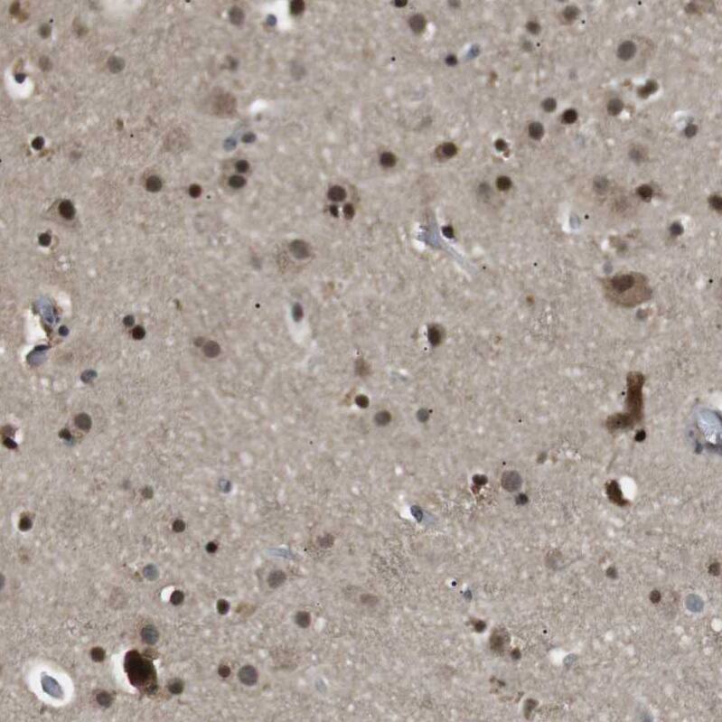 ORAI3 Antibody - BSA Free Immunohistochemistry: ORAI3 Antibody - BSA Free [NBP1-93523]