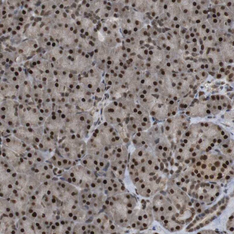 ORAI3 Antibody - BSA Free Immunohistochemistry: ORAI3 Antibody - BSA Free [NBP1-93523]