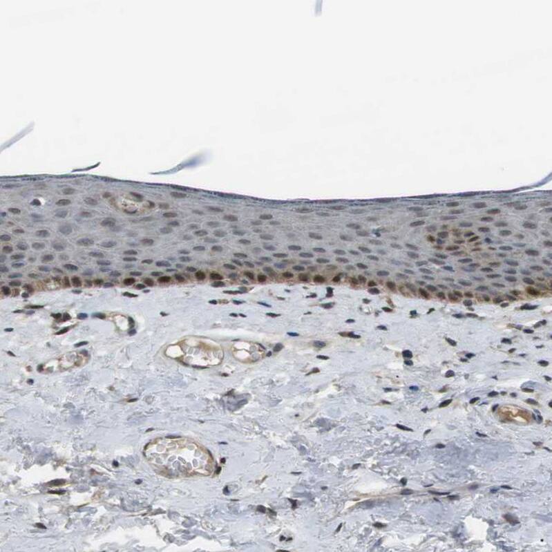 ORAI3 Antibody - BSA Free Immunohistochemistry: ORAI3 Antibody - BSA Free [NBP1-93523]