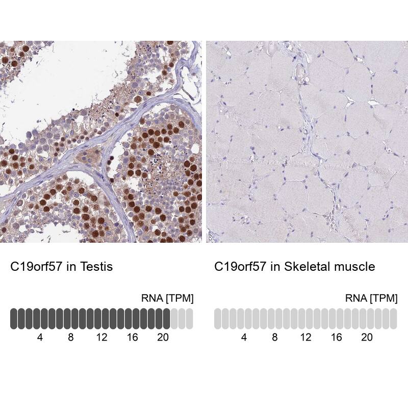 C19orf57 Antibody - BSA Free Immunohistochemistry: C19orf57 Antibody - BSA Free [NBP1-93524]