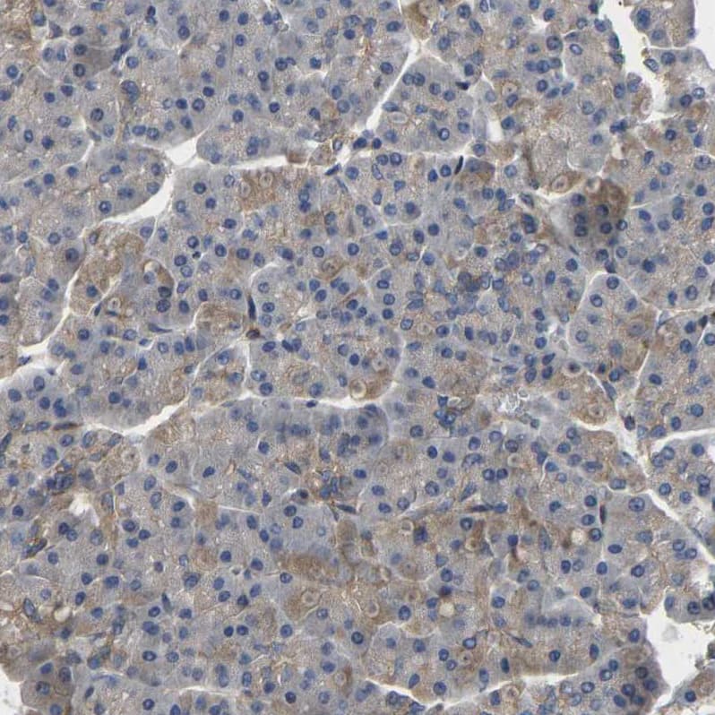 METTL21D Antibody - BSA Free Immunohistochemistry: METTL21D Antibody - BSA Free [NBP1-93526]
