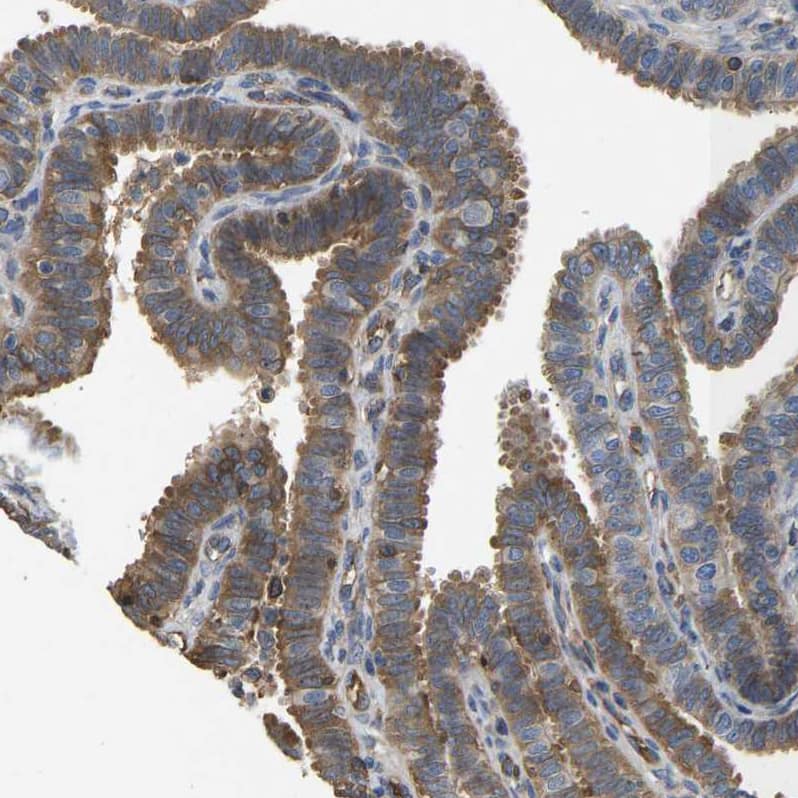 METTL21D Antibody - BSA Free Immunohistochemistry: METTL21D Antibody - BSA Free [NBP1-93526]