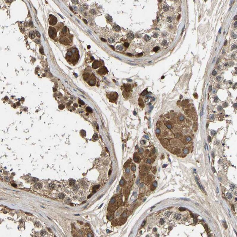 METTL21D Antibody - BSA Free Immunohistochemistry: METTL21D Antibody - BSA Free [NBP1-93526]