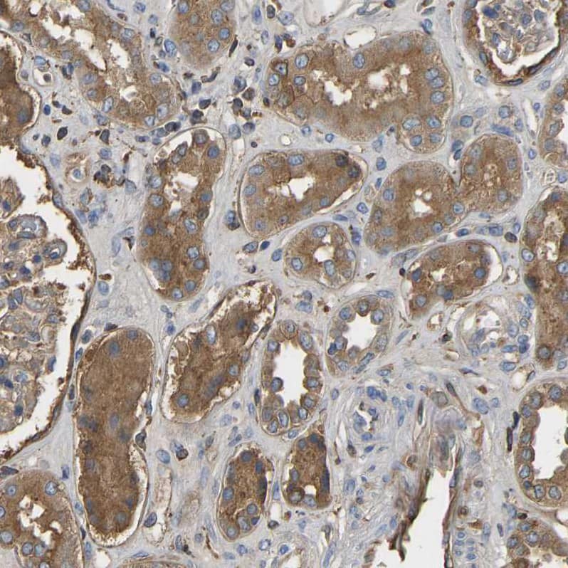 METTL21D Antibody - BSA Free Immunohistochemistry: METTL21D Antibody - BSA Free [NBP1-93526]
