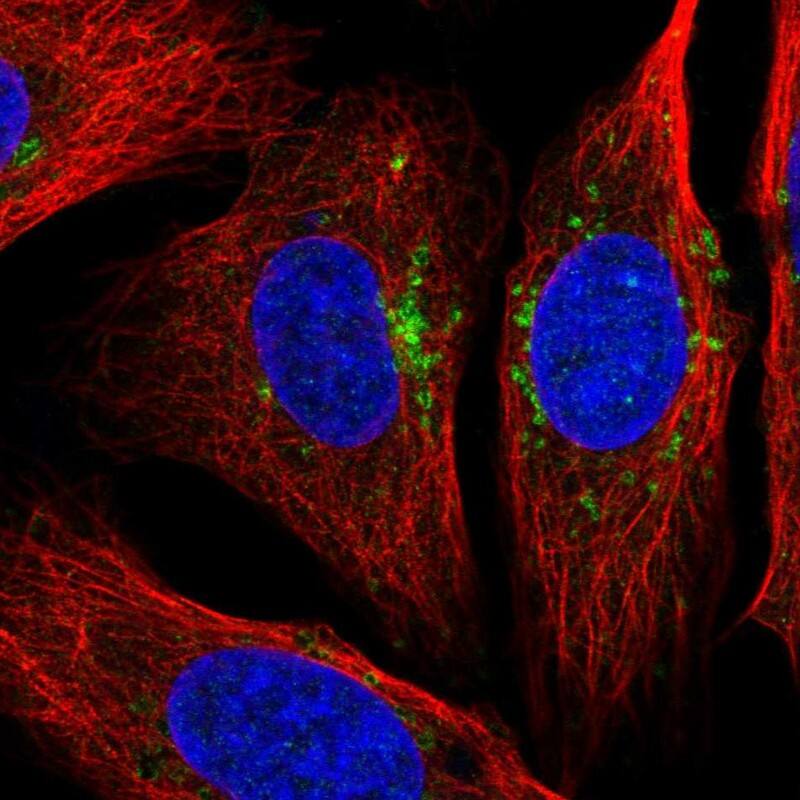 STARD3NL Antibody - BSA Free Immunocytochemistry/ Immunofluorescence: STARD3NL Antibody [NBP1-93527]