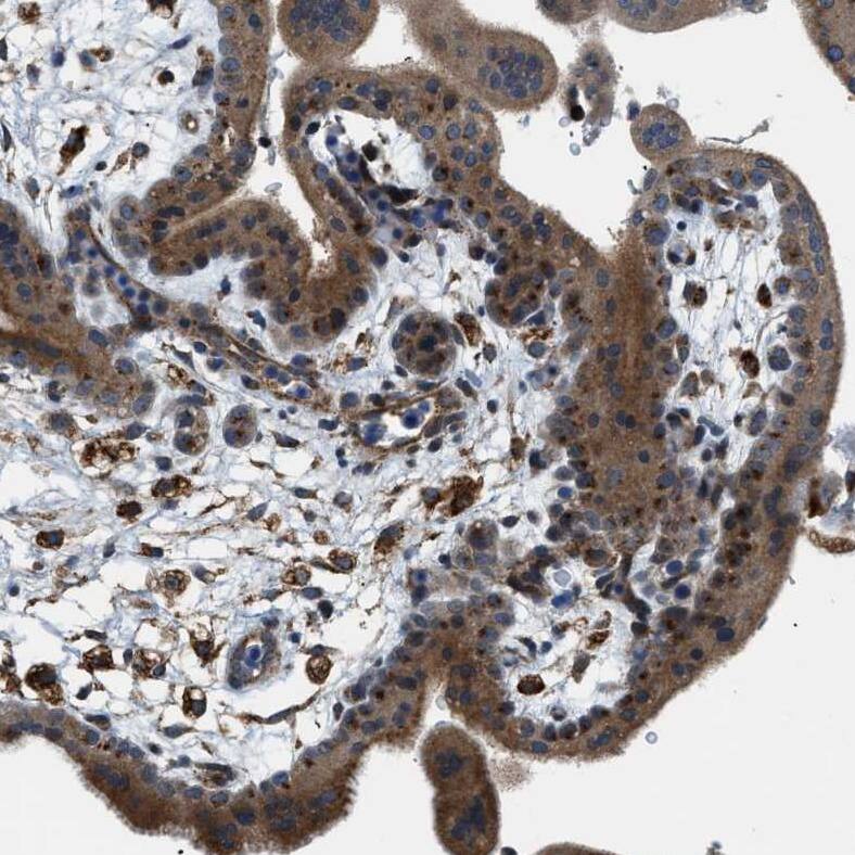 STARD3NL Antibody - BSA Free Immunohistochemistry: STARD3NL Antibody - BSA Free [NBP1-93527]