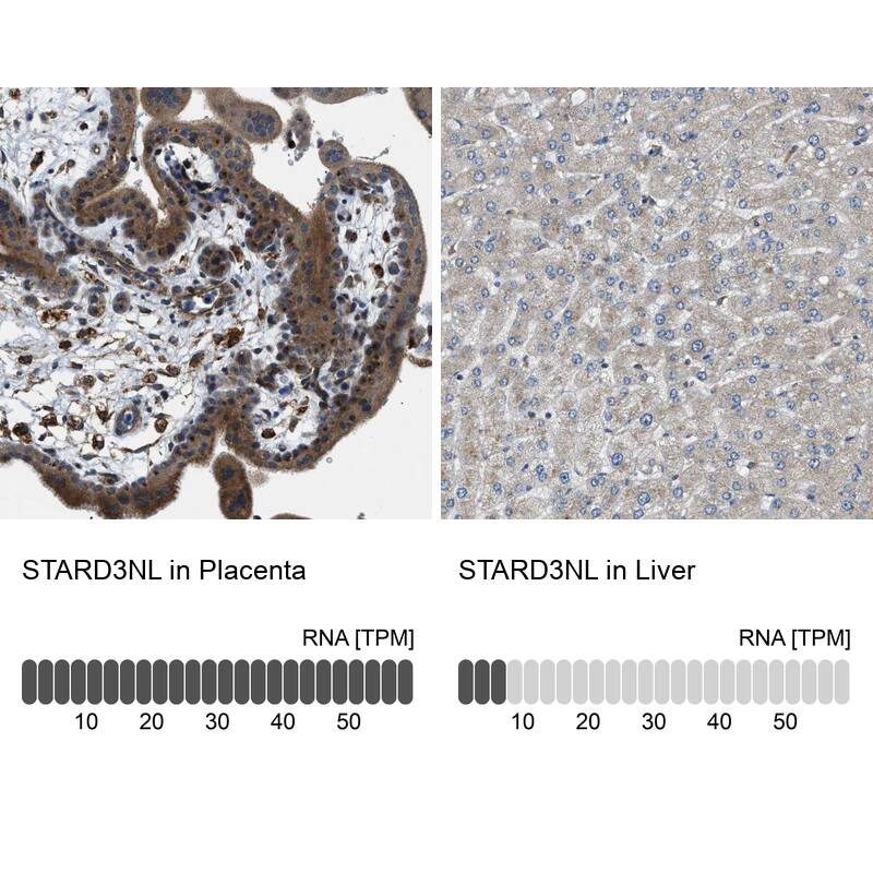 STARD3NL Antibody - BSA Free Immunohistochemistry: STARD3NL Antibody - BSA Free [NBP1-93527]