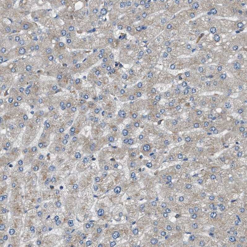 STARD3NL Antibody - BSA Free Immunohistochemistry: STARD3NL Antibody - BSA Free [NBP1-93527]
