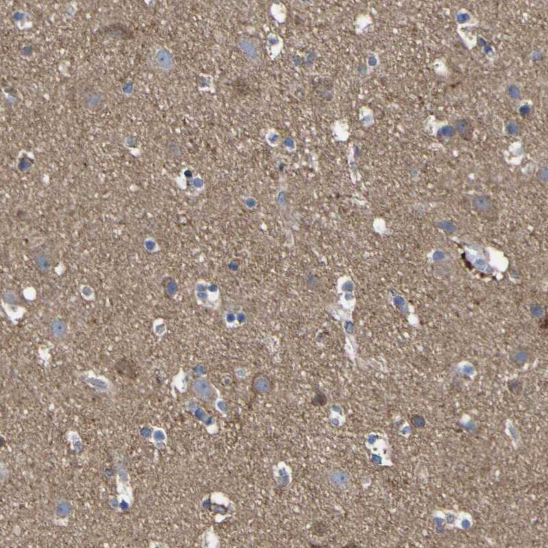 CCDC90B Antibody - BSA Free Immunohistochemistry: CCDC90B Antibody - BSA Free [NBP1-93528]