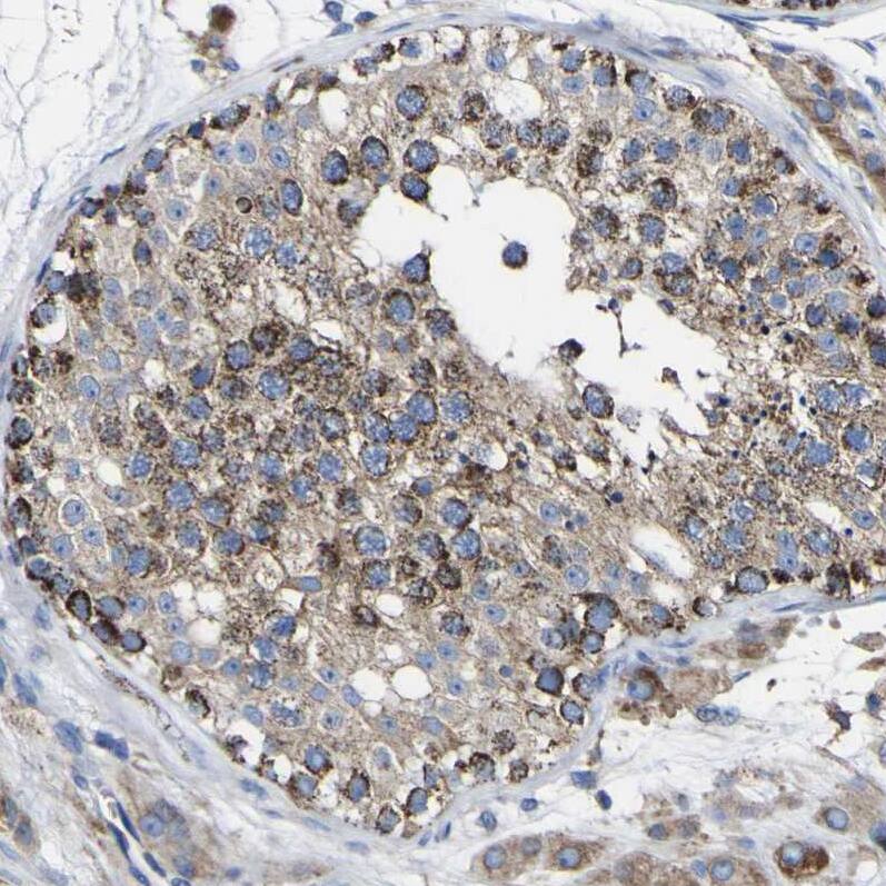 CCDC90B Antibody - BSA Free Immunohistochemistry: CCDC90B Antibody - BSA Free [NBP1-93529]