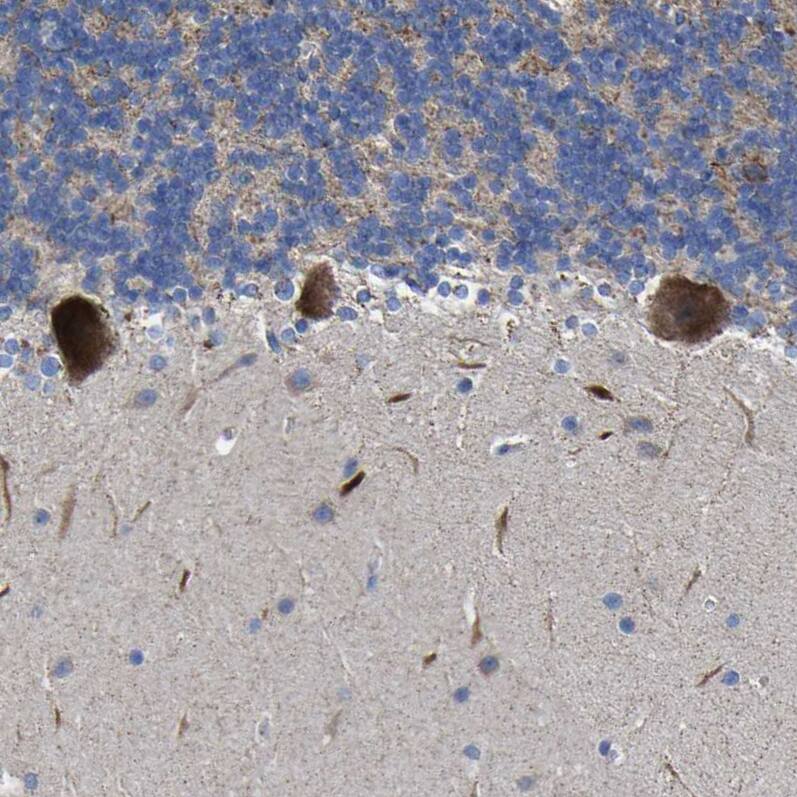CCDC90B Antibody - BSA Free Immunohistochemistry: CCDC90B Antibody - BSA Free [NBP1-93529]