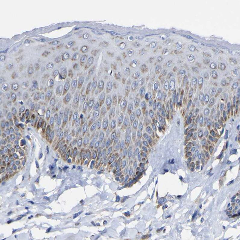 CCDC90B Antibody - BSA Free Immunohistochemistry: CCDC90B Antibody - BSA Free [NBP1-93529]