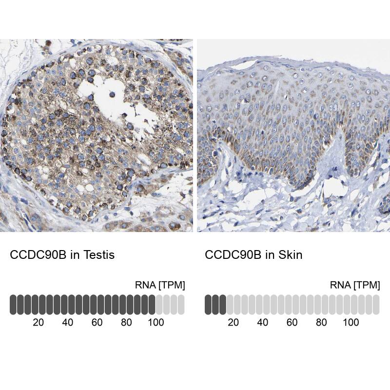 CCDC90B Antibody - BSA Free Immunohistochemistry: CCDC90B Antibody - BSA Free [NBP1-93529]