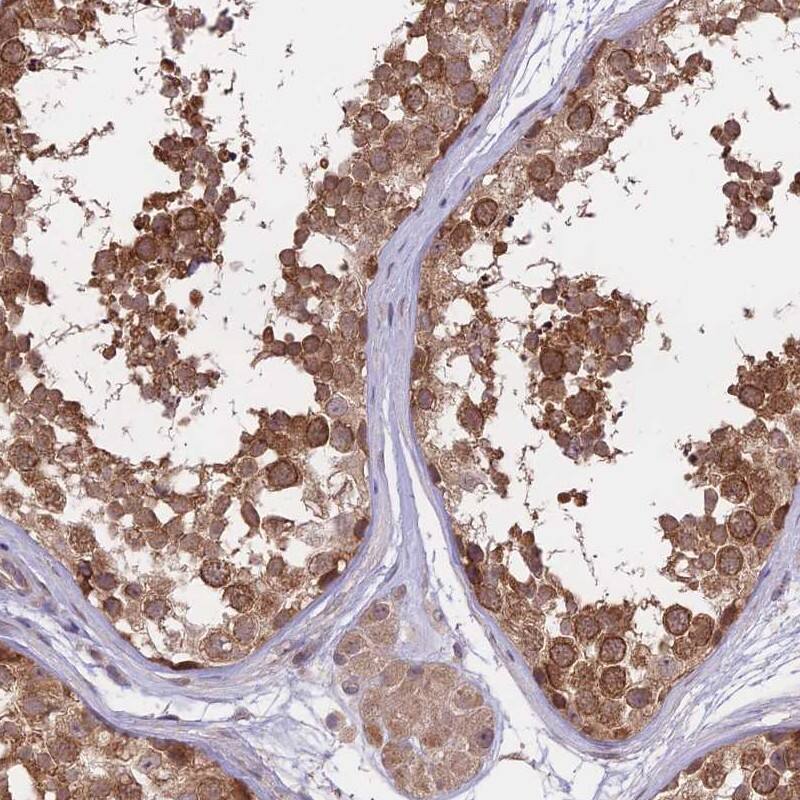 FABP12 Antibody - BSA Free Immunohistochemistry: FABP12 Antibody - BSA Free [NBP1-93537]