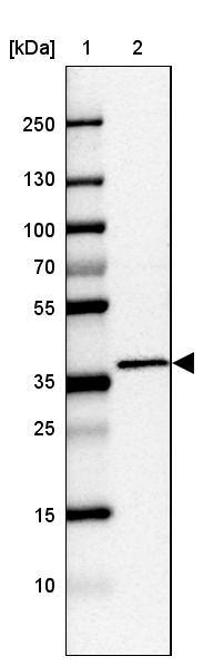 C2orf72 Antibody - BSA Free Western Blot: C2orf72 Antibody - BSA Free [NBP1-93551]