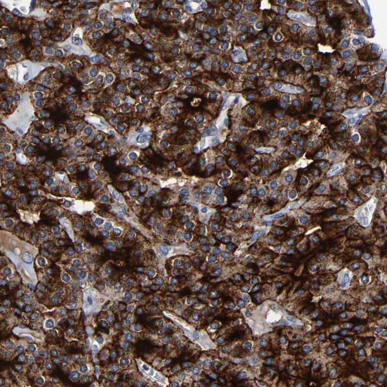LRRC70 Antibody - BSA Free Immunohistochemistry: LRRC70 Antibody - BSA Free [NBP1-93554]