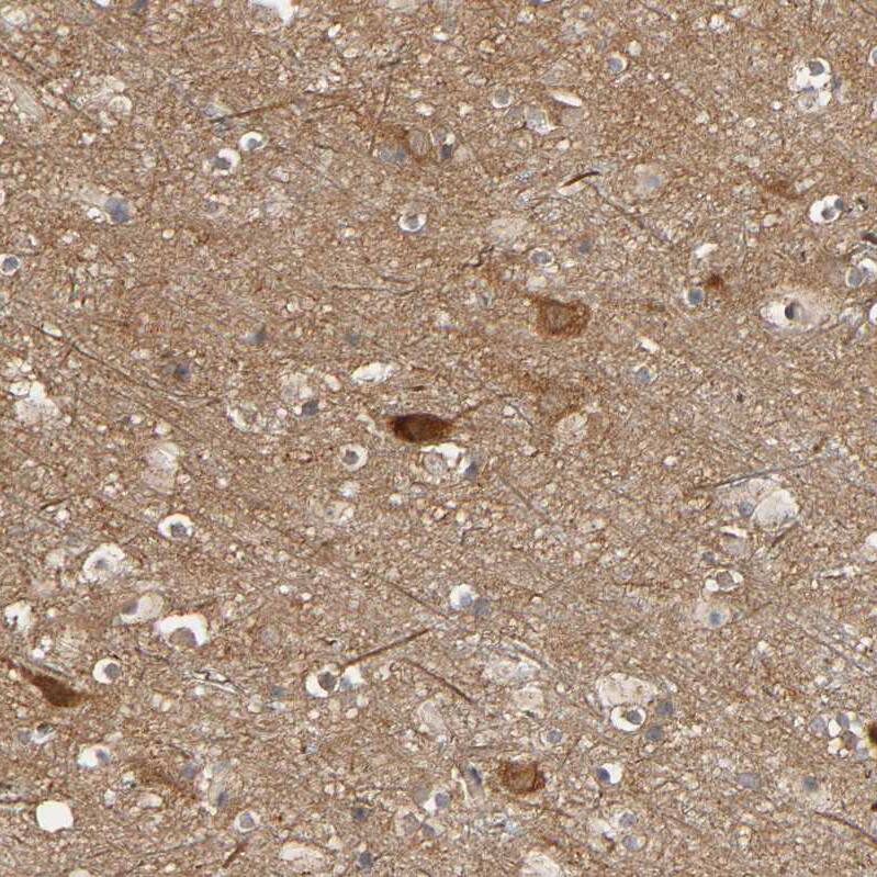SGSM1 Antibody - BSA Free Immunohistochemistry: SGSM1 Antibody - BSA Free [NBP1-93564]