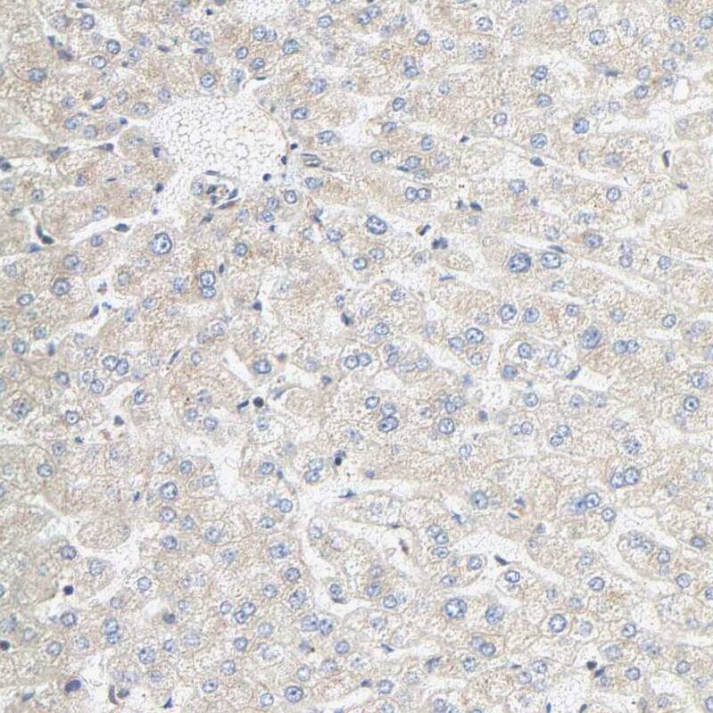 SGSM1 Antibody - BSA Free Immunohistochemistry: SGSM1 Antibody - BSA Free [NBP1-93564]