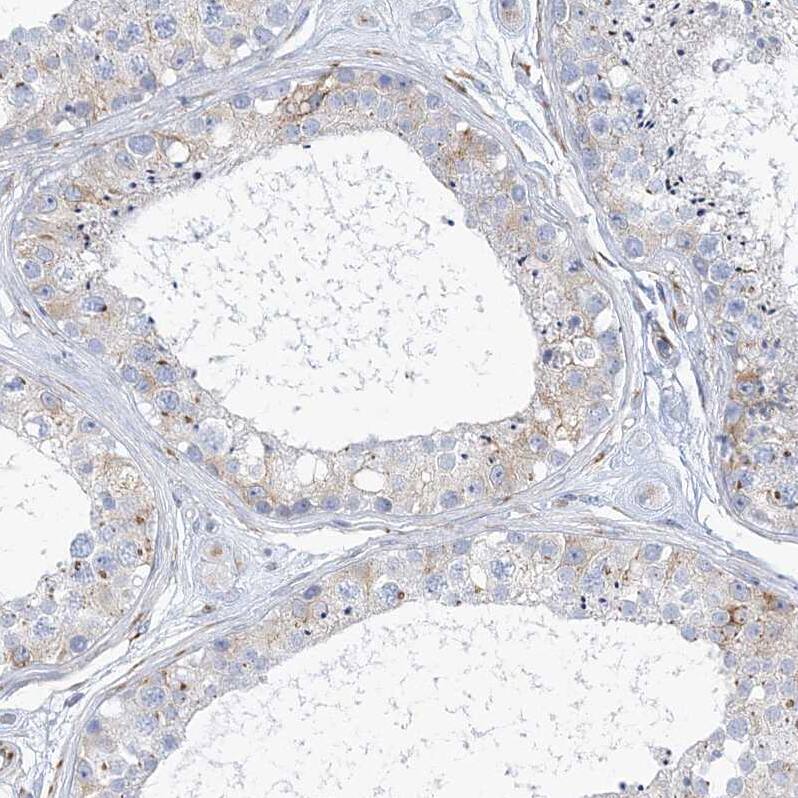 PLEKHG4B Antibody - BSA Free Immunohistochemistry: PLEKHG4B Antibody - BSA Free [NBP1-93566]