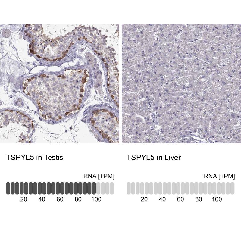 TSPYL5 Antibody - BSA Free Immunohistochemistry: TSPYL5 Antibody - BSA Free [NBP1-93578]