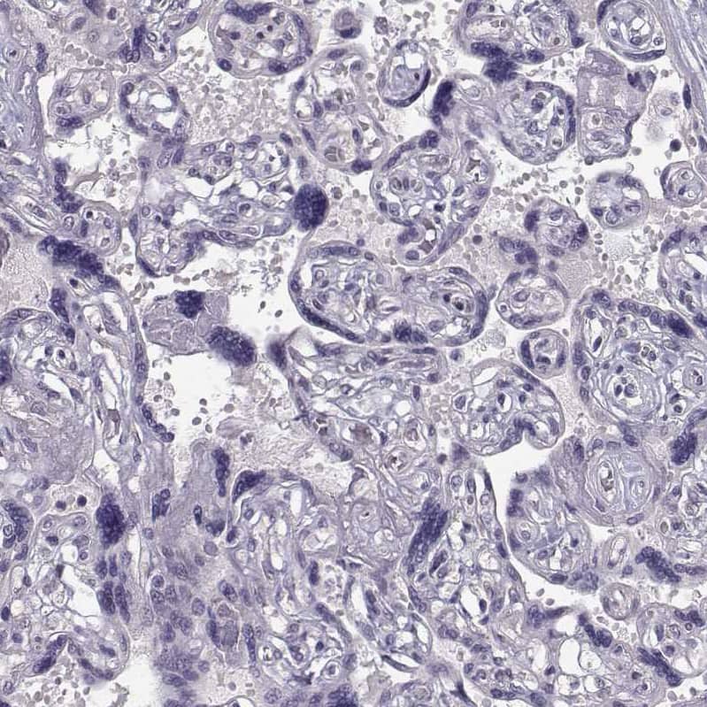 TSPYL5 Antibody - BSA Free Immunohistochemistry: TSPYL5 Antibody - BSA Free [NBP1-93578]