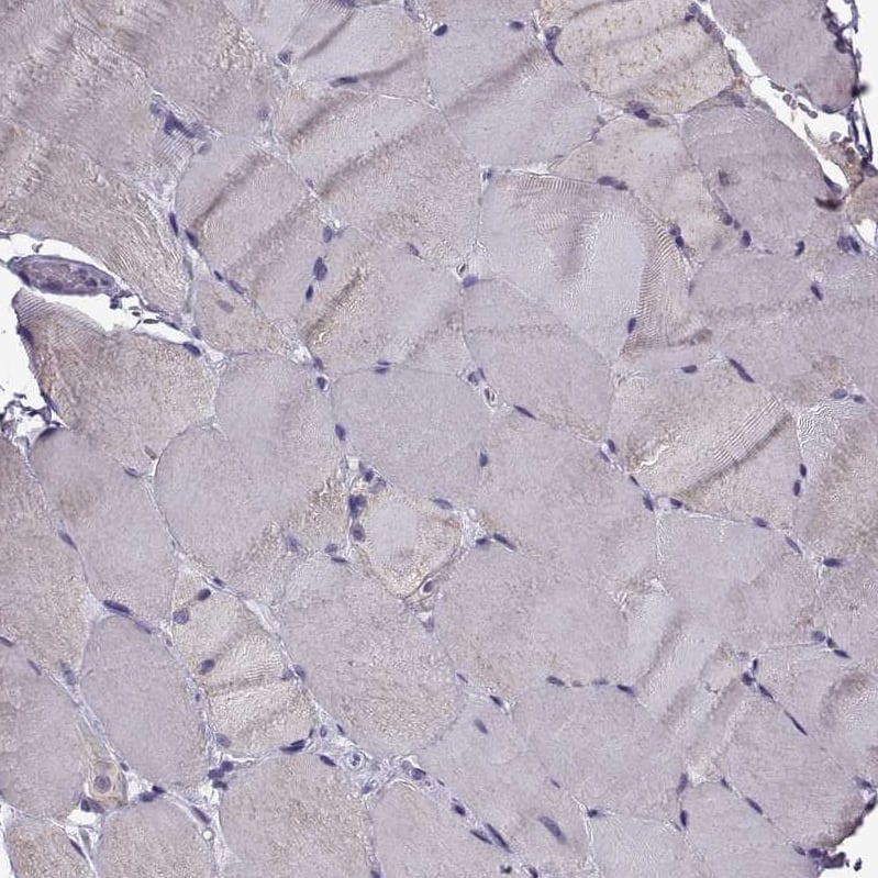 TSPYL5 Antibody - BSA Free Immunohistochemistry: TSPYL5 Antibody - BSA Free [NBP1-93578]
