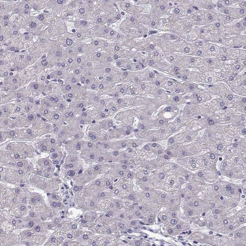 TSPYL5 Antibody - BSA Free Immunohistochemistry: TSPYL5 Antibody - BSA Free [NBP1-93578]