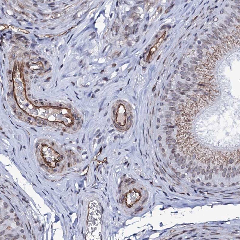 ZC3H12C Antibody - BSA Free Immunohistochemistry-Paraffin: ZC3H12C Antibody [NBP1-93580]